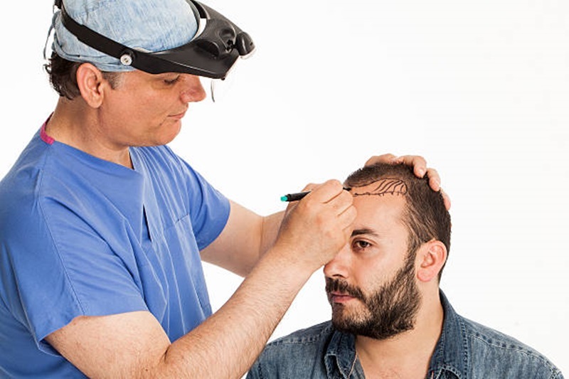Why is Turkey the most popular Hair Transplant point?
