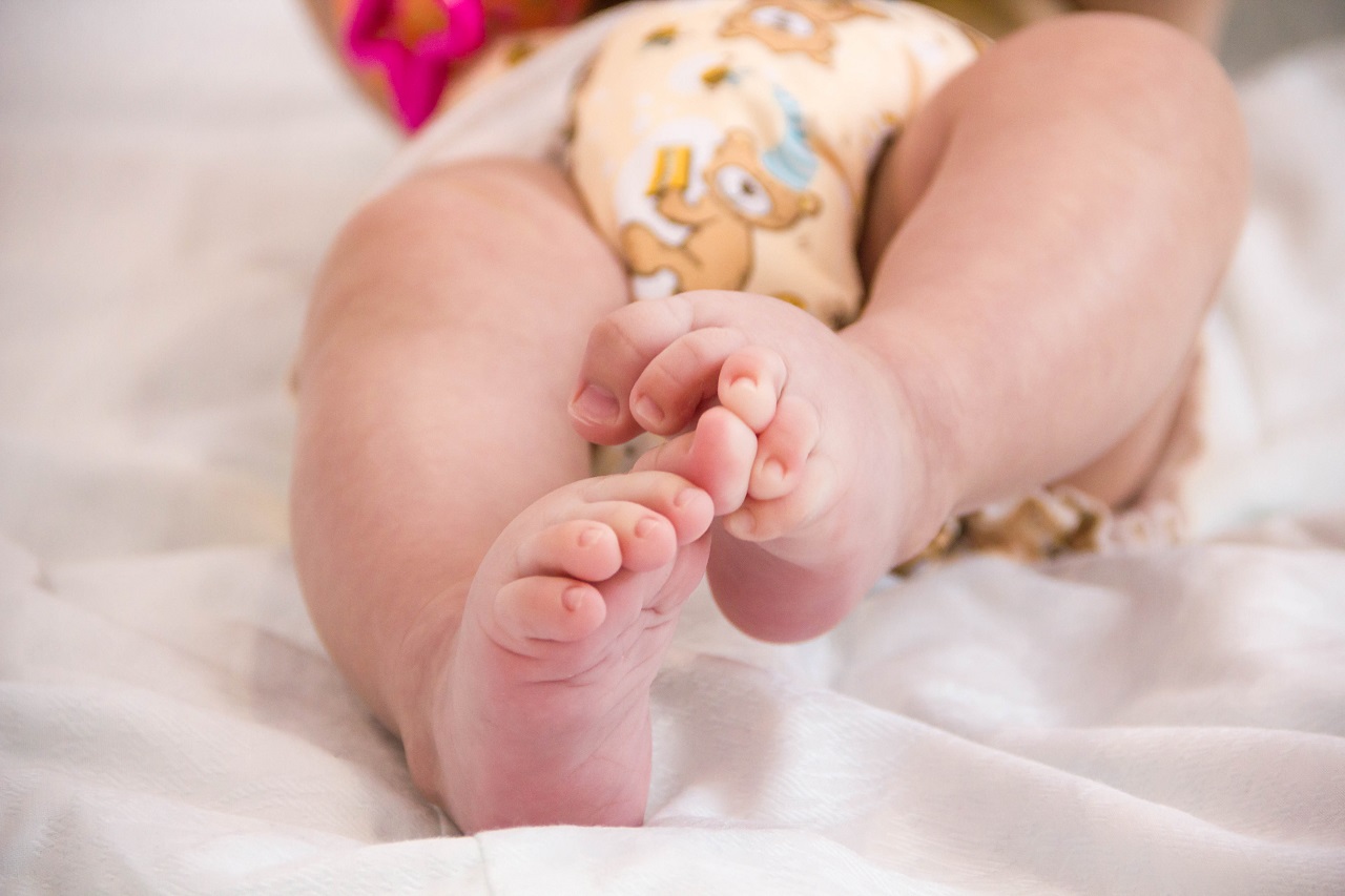 How do you get rid of clubfoot?