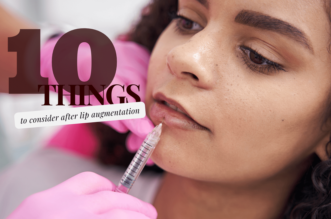 10 things to consider after lip augmentation
